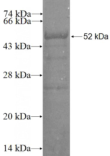 Recombinant Human RABL3 SDS-PAGE