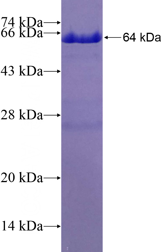 Recombinant Human COG7 SDS-PAGE
