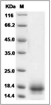 Rat CD59 / CD59A / MAC / IP Protein (His Tag) SDS-PAGE