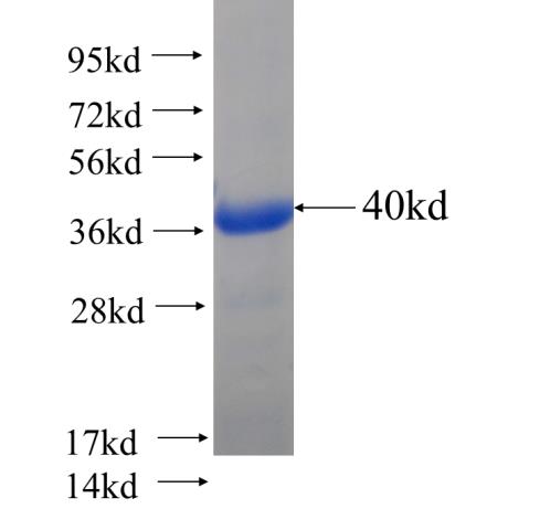 Recombinant human Perforin SDS-PAGE