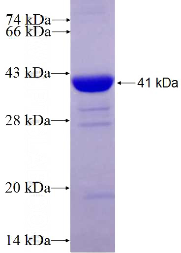 Recombinant Human RPS6KA5 SDS-PAGE