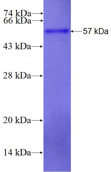 Recombinant Human NEXN SDS-PAGE
