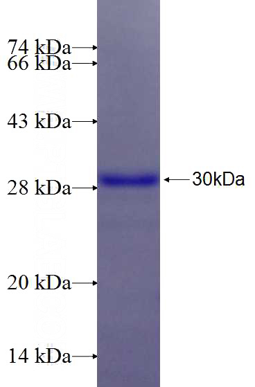 Recombinant Human IFT74 SDS-PAGE