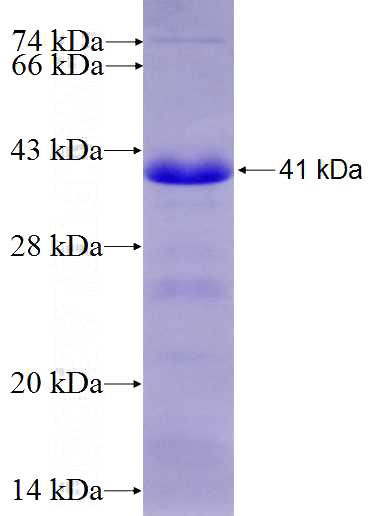 Recombinant Human CDH7 SDS-PAGE