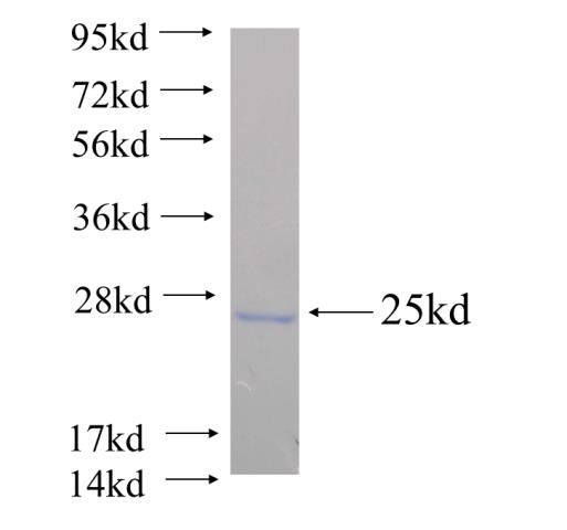 Recombinant human OCA2 SDS-PAGE
