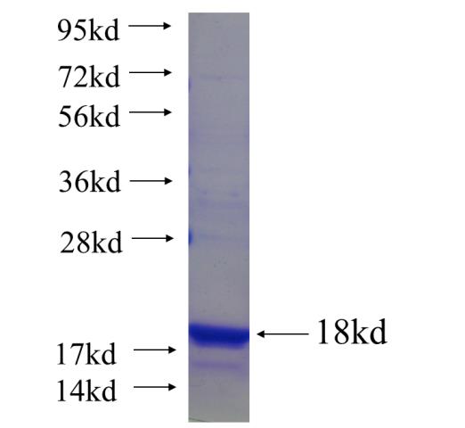 Recombinant human GJA5 SDS-PAGE