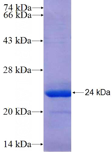 Recombinant Human C13orf1 SDS-PAGE