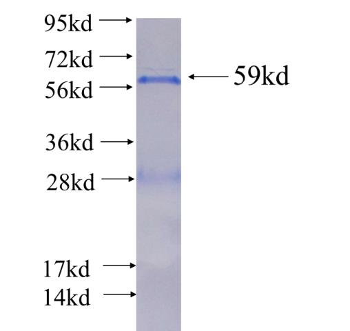 Recombinant human SH3GL3(Full length) SDS-PAGE