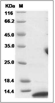 Human VAMP3 / Cellubrevin Protein (His Tag) SDS-PAGE