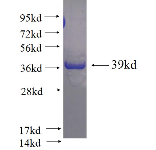 Recombinant human SLC25A5 SDS-PAGE