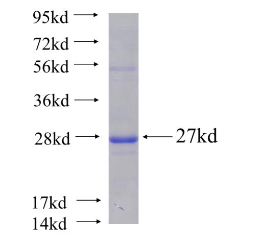 Recombinant human RAP2B(Full length) SDS-PAGE