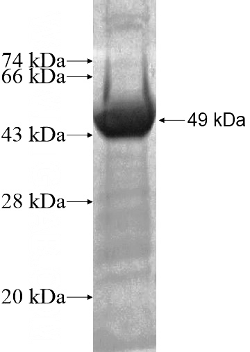 Recombinant Human EDC4 SDS-PAGE
