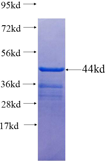 Recombinant Human SH3BP5L SDS-PAGE