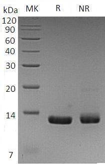 Human CCL8/MCP2/SCYA10/SCYA8 (His tag) recombinant protein