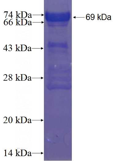 Recombinant Human ZNF828 SDS-PAGE