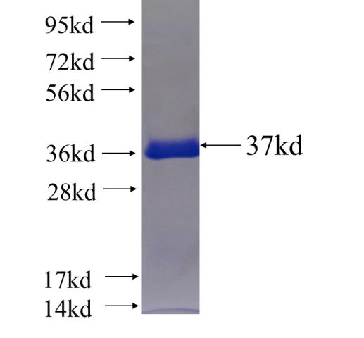 Recombinant human KIAA0430 SDS-PAGE