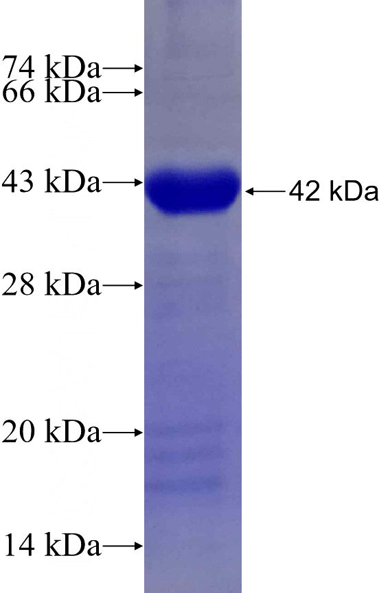 Recombinant Human ANKRD1 SDS-PAGE