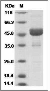 Human Ephrin-A4 / EFNA4 Protein (Fc Tag) SDS-PAGE