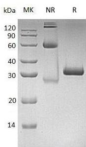 Human MBL2/COLEC1/MBL (His tag) recombinant protein