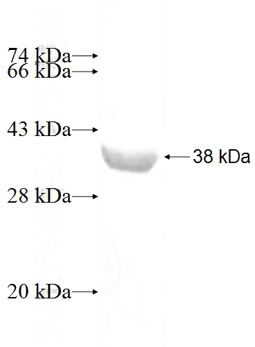 Recombinant Human USP36 SDS-PAGE