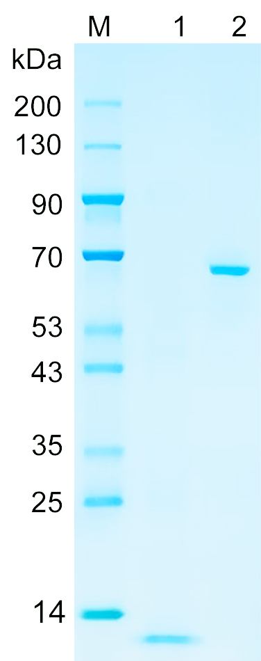 Recombinant TVA21 protein (His tag) SDS-PAGE
