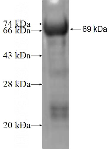 Recombinant Human IKIP SDS-PAGE