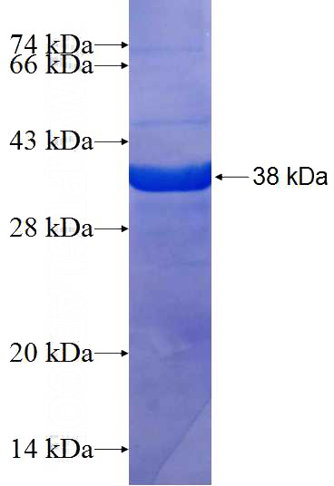 Recombinant Human SDCBP2 SDS-PAGE