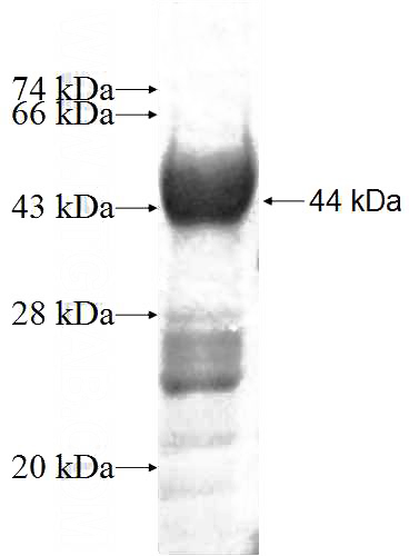 Recombinant Human CTPS SDS-PAGE