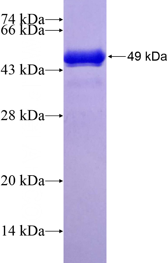 Recombinant Human LAMA1 SDS-PAGE