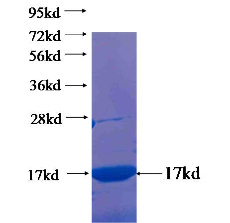 Recombinant human TEX15 SDS-PAGE