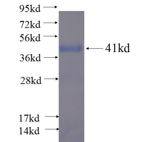 Recombinant human ARHGAP22 SDS-PAGE