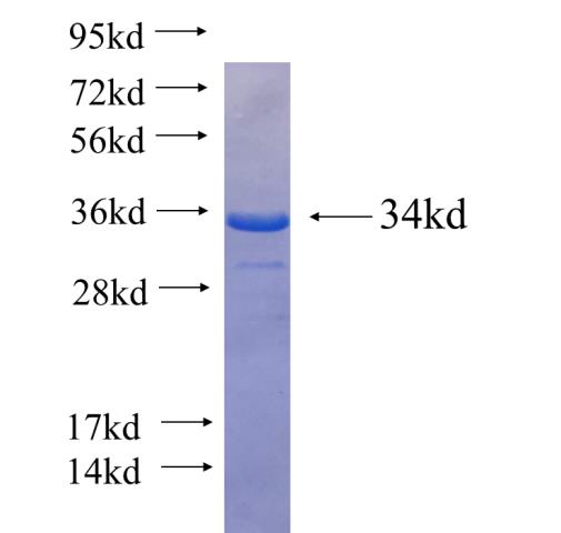 Recombinant human RWDD1(Full length) SDS-PAGE